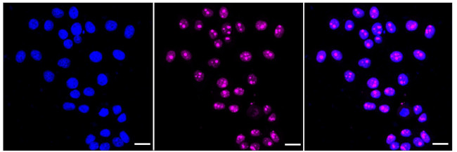 PHF8 Antibody in Immunocytochemistry (ICC/IF)