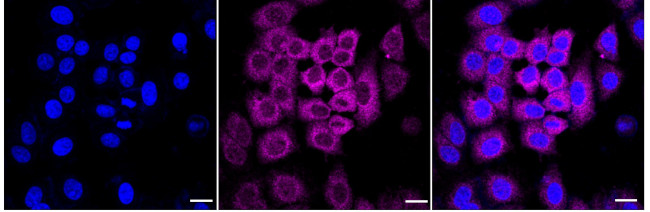 PDE4D Antibody in Immunocytochemistry (ICC/IF)