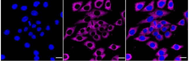 PGM1 Antibody in Immunocytochemistry (ICC/IF)