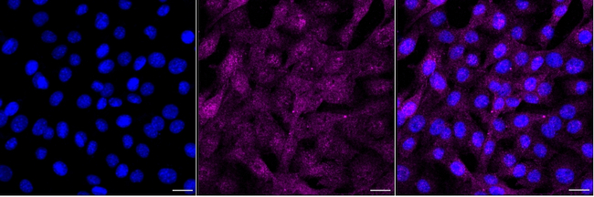 Phospho-LAT (Tyr220) Antibody in Immunocytochemistry (ICC/IF)