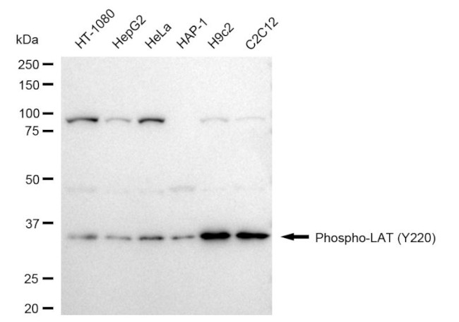 Phospho-LAT (Tyr220) Antibody in Western Blot (WB)