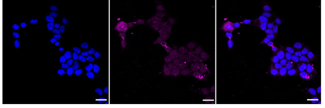Phospho-PRKD2 (Ser876) Antibody in Immunocytochemistry (ICC/IF)