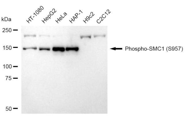 Phospho-SMC1 (Ser957) Antibody in Western Blot (WB)