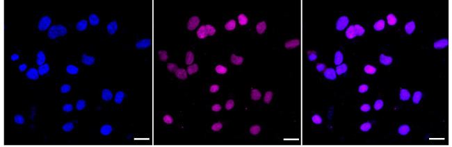 PIAS1/PIAS2 Antibody in Immunocytochemistry (ICC/IF)