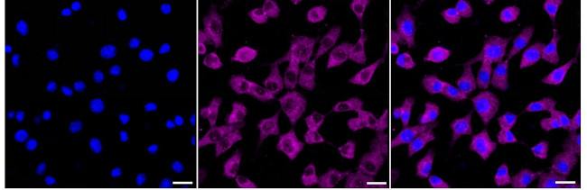 PKC alpha/beta/gamma Antibody in Immunocytochemistry (ICC/IF)