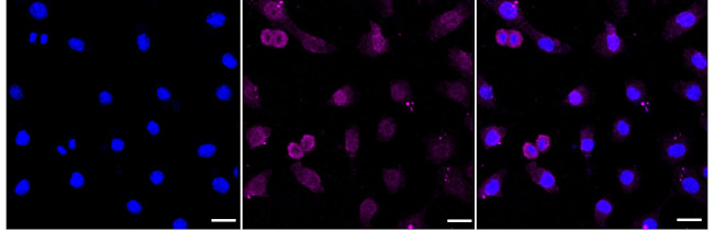 Pleiotrophin Antibody in Immunocytochemistry (ICC/IF)