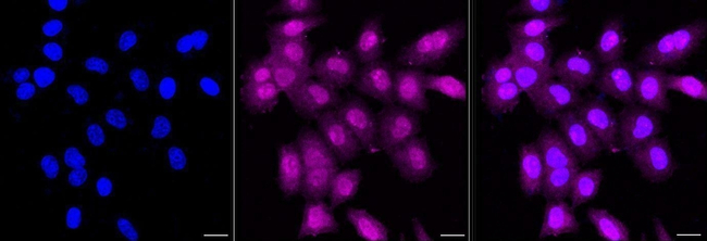 PP1 alpha/beta Antibody in Immunocytochemistry (ICC/IF)