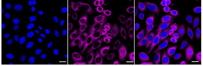 PPP2R5D Antibody in Immunocytochemistry (ICC/IF)