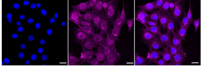 AMPK gamma-1 Antibody in Immunocytochemistry (ICC/IF)