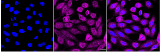 PSAP Antibody in Immunocytochemistry (ICC/IF)