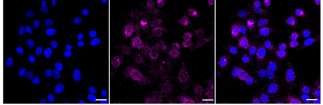 PKC eta Antibody in Immunocytochemistry (ICC/IF)