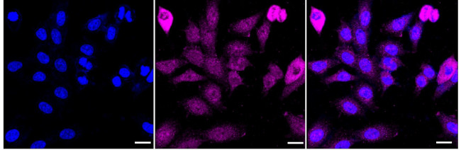 PSMD4 Antibody in Immunocytochemistry (ICC/IF)