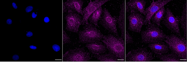 RAB22A Antibody in Immunocytochemistry (ICC/IF)