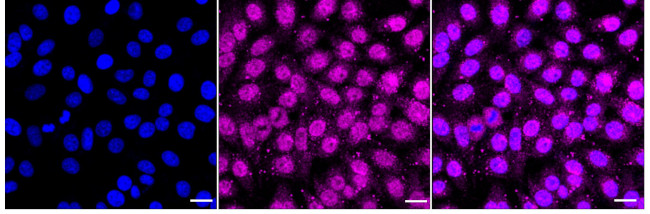 RAB5C Antibody in Immunocytochemistry (ICC/IF)