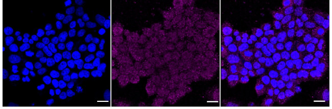 RAD51D Antibody in Immunocytochemistry (ICC/IF)