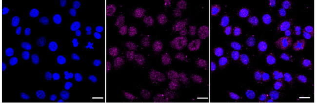 RAD52 Antibody in Immunocytochemistry (ICC/IF)