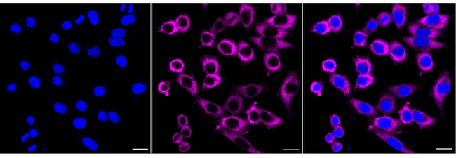 RAMP1 Antibody in Immunocytochemistry (ICC/IF)