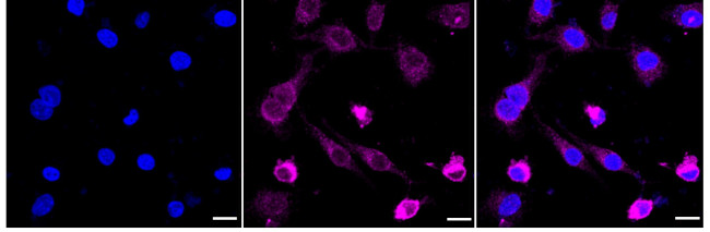 RAP1A/RAP1B Antibody in Immunocytochemistry (ICC/IF)