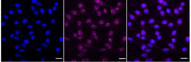RYK Antibody in Immunocytochemistry (ICC/IF)