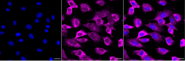 RCAN1 Antibody in Immunocytochemistry (ICC/IF)
