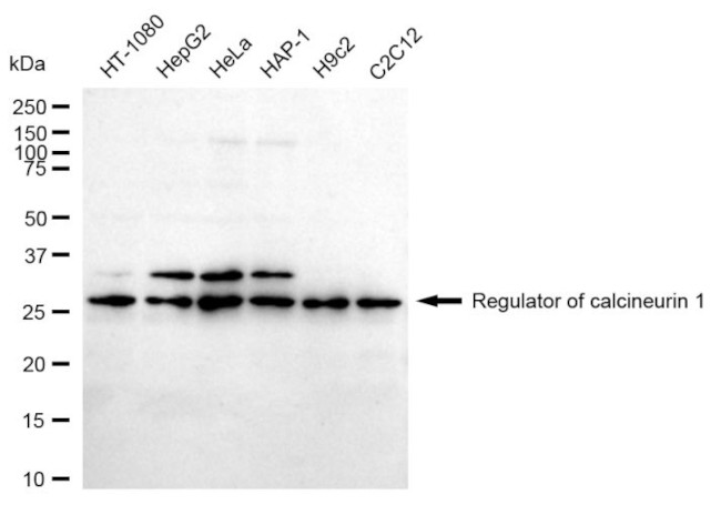 RCAN1 Antibody in Western Blot (WB)