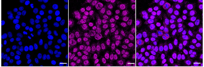 RGS6 Antibody in Immunocytochemistry (ICC/IF)
