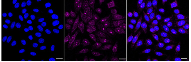 RGMA Antibody in Immunocytochemistry (ICC/IF)