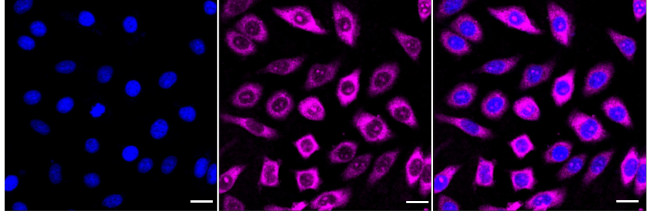 RPL10A Antibody in Immunocytochemistry (ICC/IF)