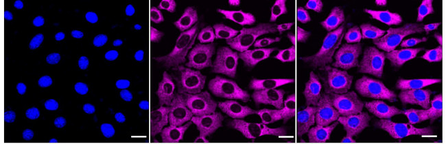 RPL13 Antibody in Immunocytochemistry (ICC/IF)