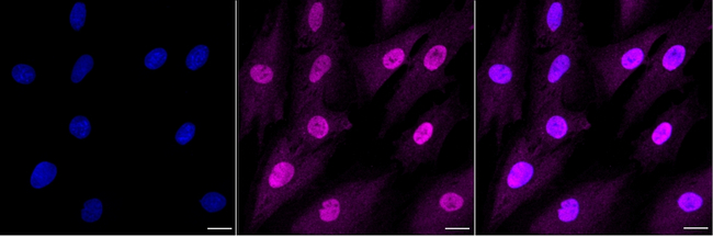ROC1 Antibody in Immunocytochemistry (ICC/IF)