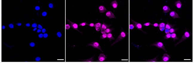 RBM8A Antibody in Immunocytochemistry (ICC/IF)