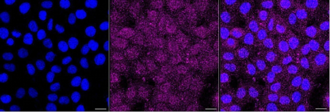RIG-I Antibody in Immunocytochemistry (ICC/IF)