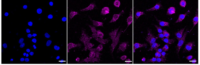 ROR2 Antibody in Immunocytochemistry (ICC/IF)