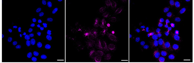 RUVBL1 Antibody in Immunocytochemistry (ICC/IF)