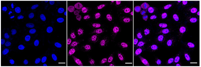 SART1 Antibody in Immunocytochemistry (ICC/IF)
