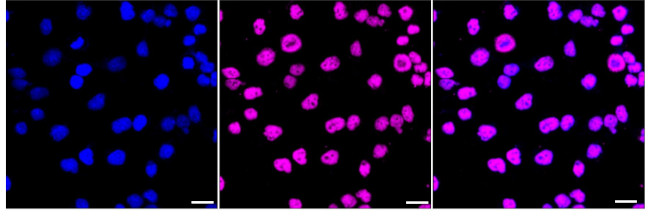SAFB Antibody in Immunocytochemistry (ICC/IF)