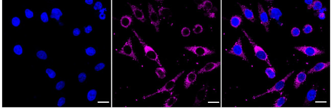 SEC61alpha Antibody in Immunocytochemistry (ICC/IF)