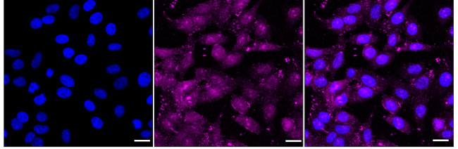 SRP19 Antibody in Immunocytochemistry (ICC/IF)