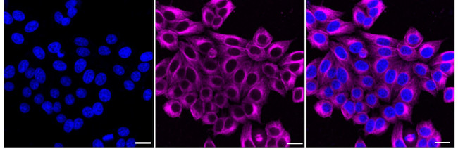 SLIT2 Antibody in Immunocytochemistry (ICC/IF)