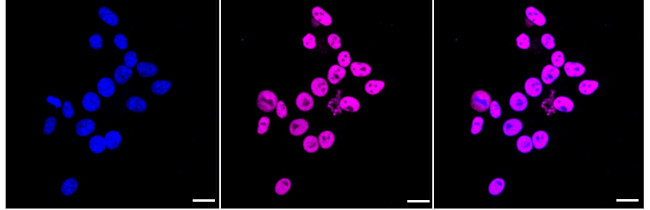 SMC1 Antibody in Immunocytochemistry (ICC/IF)