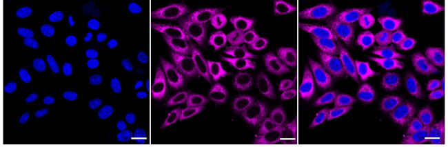 SLC22A1 Antibody in Immunocytochemistry (ICC/IF)