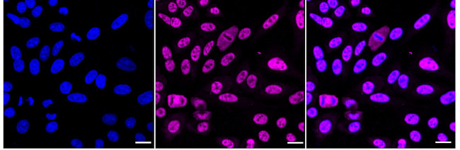ENT2 Antibody in Immunocytochemistry (ICC/IF)