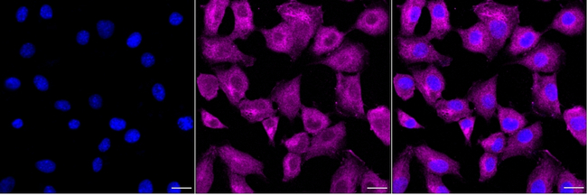SLC6A1 Antibody in Immunocytochemistry (ICC/IF)