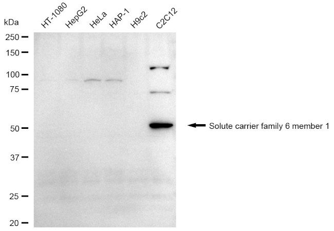 SLC6A1 Antibody in Western Blot (WB)