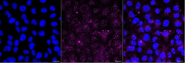 Dopamine Transporter Antibody in Immunocytochemistry (ICC/IF)
