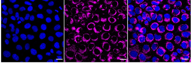 SPRY2 Antibody in Immunocytochemistry (ICC/IF)