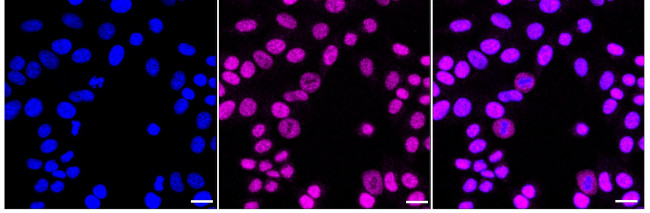 SRSF6 Antibody in Immunocytochemistry (ICC/IF)