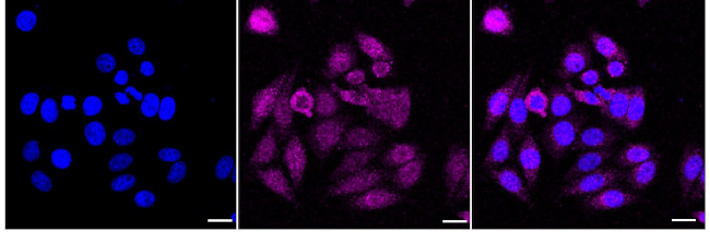 SRD5A2 Antibody in Immunocytochemistry (ICC/IF)