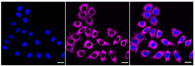 SCP2 Antibody in Immunocytochemistry (ICC/IF)