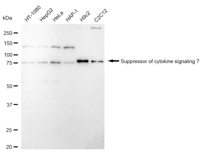SOCS7 Antibody in Western Blot (WB)